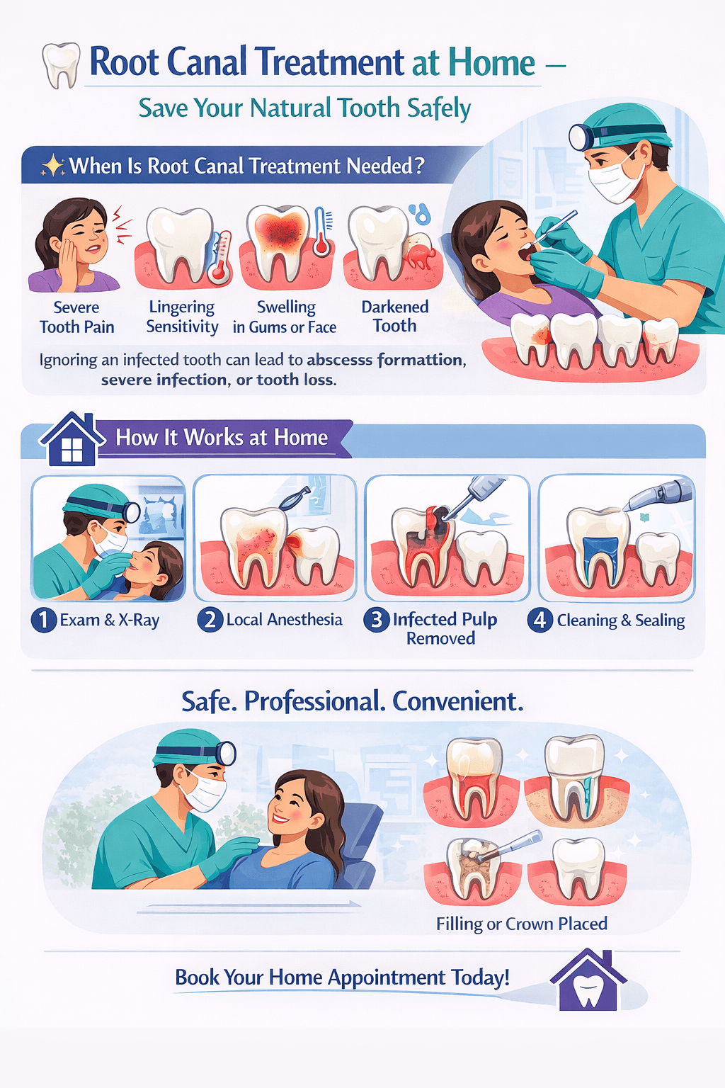 Root Canal at Home