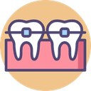 Braces