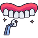 Composite Veneers