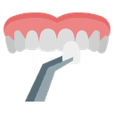 Emax Veneers